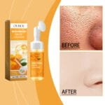 OUHOE Turmeric Cleanser Gently Cleanses Facial Skin, Moistens, Nourishes And Nourishes Skin Without Straining